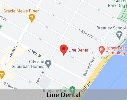 Map image for I Think My Gums Are Receding in New York, NY